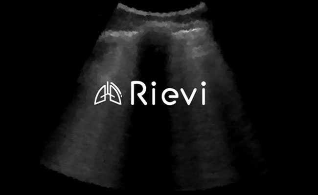 Yapay Zeka ile Akciğer Ultrasonu Değerlendirmesi